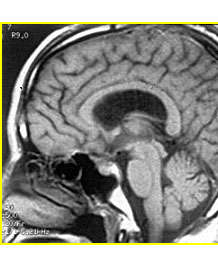 �򽨿�����Փ�ģ����Y(ji��)��(ji��)�XĤ�������g(sh��)��·�ͼ���