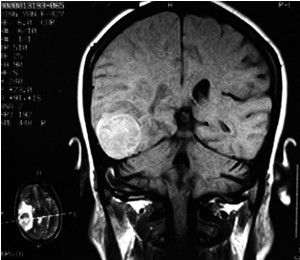 �XĤ�����g(sh��)��Ҫע�������{(di��o)�B(y��ng)��