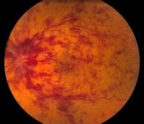 ҕ�W(w��ng)Ĥ�����o�}��������ʲôԭ���������