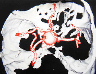 �򽨿�����Փ�ģ��B��(n��i)�޴��(d��ng)�}�����@΢������g(sh��)�ί�