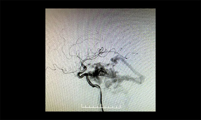 DSA�z���@ʾ�����(c��)��Ļ�^(q��)Ӳ�XĤ���o�}��