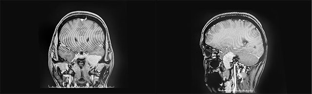 �[��λ������B�иC�D�~��(n��i)�ȵײ�