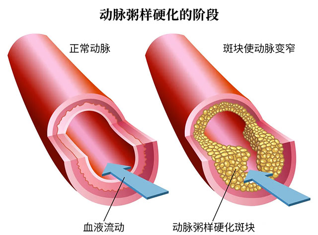 ��(d��ng)�}����Ӳ���������i��(d��ng)�}�Mխ���Ҋԭ��