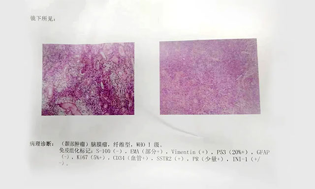 ��Ԫ�������XĤ��