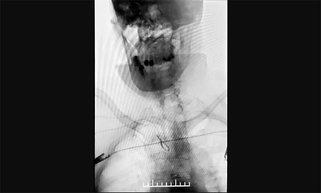 �c���y(t��ng)��(j��ng)�Ʉ�(d��ng)�}�����XѪ����Ӱ�������(j��ng)���(d��ng)�}������Ӱ����(du��)��(f��)�s�������g(sh��)��(chu��ng)��С�������c(di��n)Ѫ�[�l(f��)�����^��