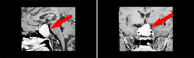 �[�����u���L�����@�i��(n��i)���}��knosp�ּ�IV��