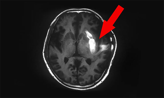 �X��Ѫ��λ�R�����܅^(q��)����ʹ�����҂�(c��)֫�wƫ