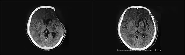 �B�����a(b��)ǰ(��)��(��)