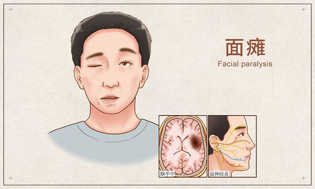 ��������� ͻ�l(f��)��c���ܹ�������(j��ng)��(n��i)����־�����������t(y��)�Y(ji��)��׌���ط���λ