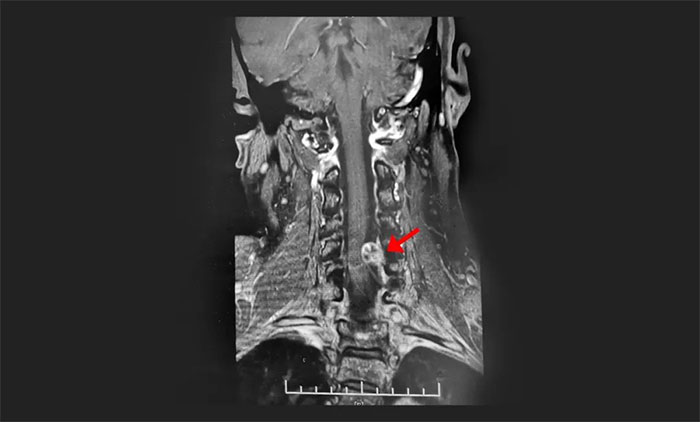 �@�N�[�����ױ���(d��ng)���i׵�����L�r(sh��)�g�i����ʹ��֫�w��ľ����Ҫ����