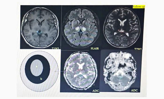 Ů�ӷ���(y��ng)�t�g������X��崙C(j��)����ԭ���ǻ���Ҋ���X�������o���F(tu��n)�(li��n)���\�Ύ���ϣ��