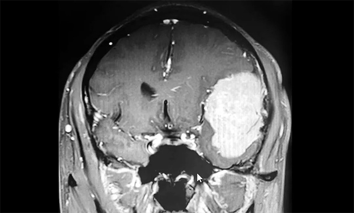 39�q����ͻȻ���R(sh��)����ˤ���ڵ� ���W(xu��)�ƅf(xi��)������г��B��(n��i)�޴��XĤ��