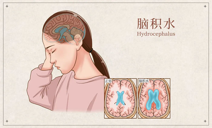 �쯛�š�ˮ�� �o��ͨ����������R���Q��ʿՄ�X�eˮ���R΢��(chu��ng)���g�ί�