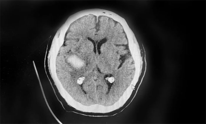 ��(y��u)�|(zh��)����(w��) �� ץס�X��Ѫ���S�𿵏�(f��)�ڡ� ���ľ��������߻֏�(f��)��������