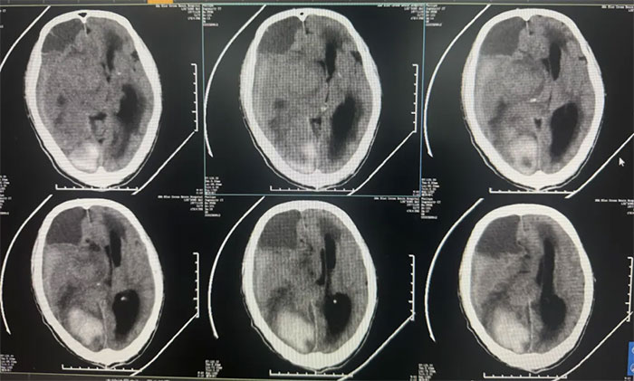 �Ϻ��{(l��n)ʮ���X���t(y��)Ժ���L(zh��ng)�r(sh��)���������������X��Һ���푪(y��ng)�ò�������һ����˼��