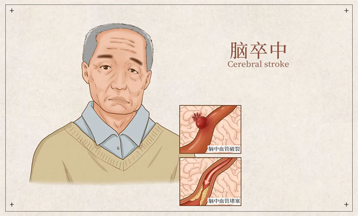 �������� �� ����������֔(j��n)���������L(f��ng)��ͻȻ���u��