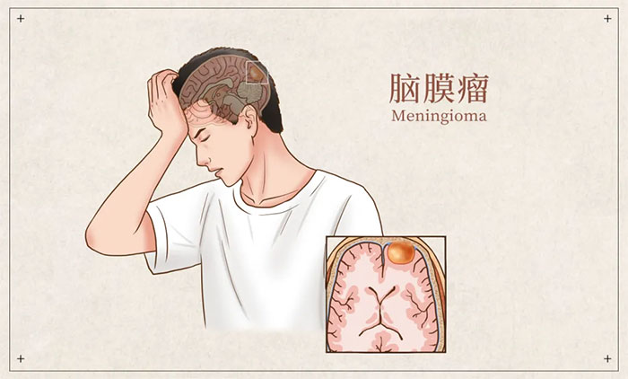 ����(f��)�^���^ʹ�e�������������X�[��ǰ�ף������R�e�@Щ��Ҋ�װl(f��)�Y��