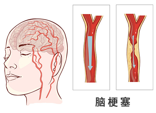 �Ҹ��HͻȻ�fԒ���壬�p�ȟo����Ո�����X�����İY�����